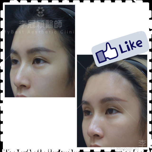 IMG_5038.PNG - 墊額頭