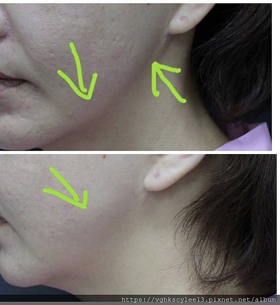 IMG_9445.jpg IMG_9445.jpg