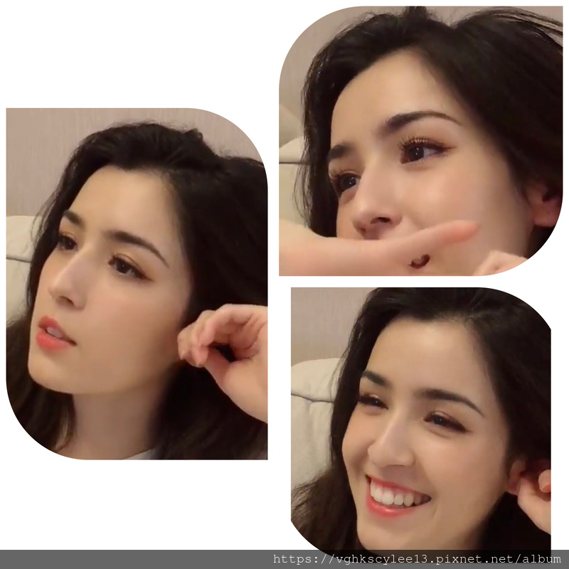 輪廓額與注射額的差異