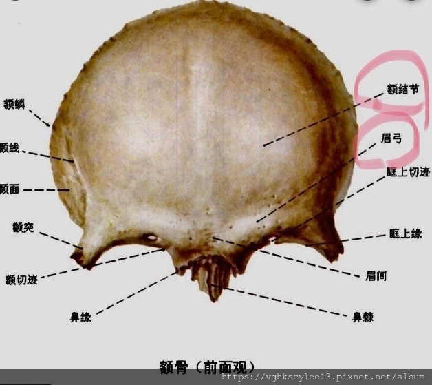 妳的豐額是哪一款的？雕塑輪廓額、假體凸額還是注射膨額？眉骨的