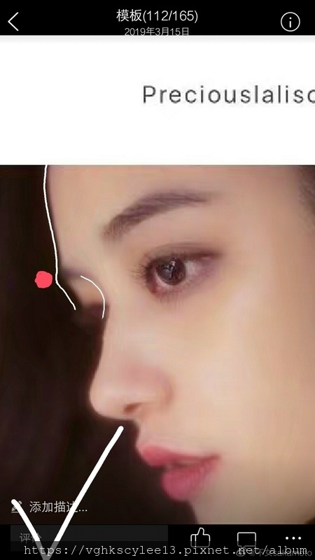 妳的豐額是哪一款的？雕塑輪廓額、假體凸額還是注射膨額？眉骨的