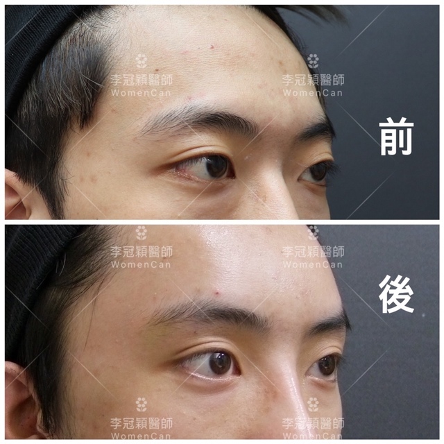 IMG_0911.JPG - 墊額頭