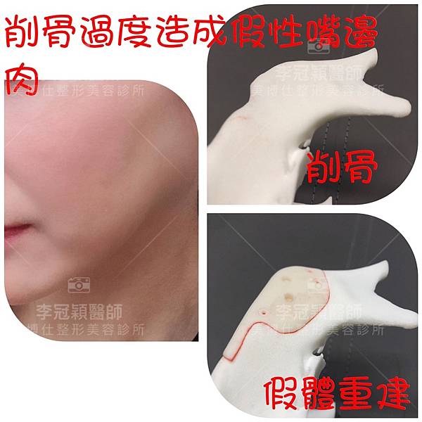 1201152965_o.jpg 1201152965_o.jpg