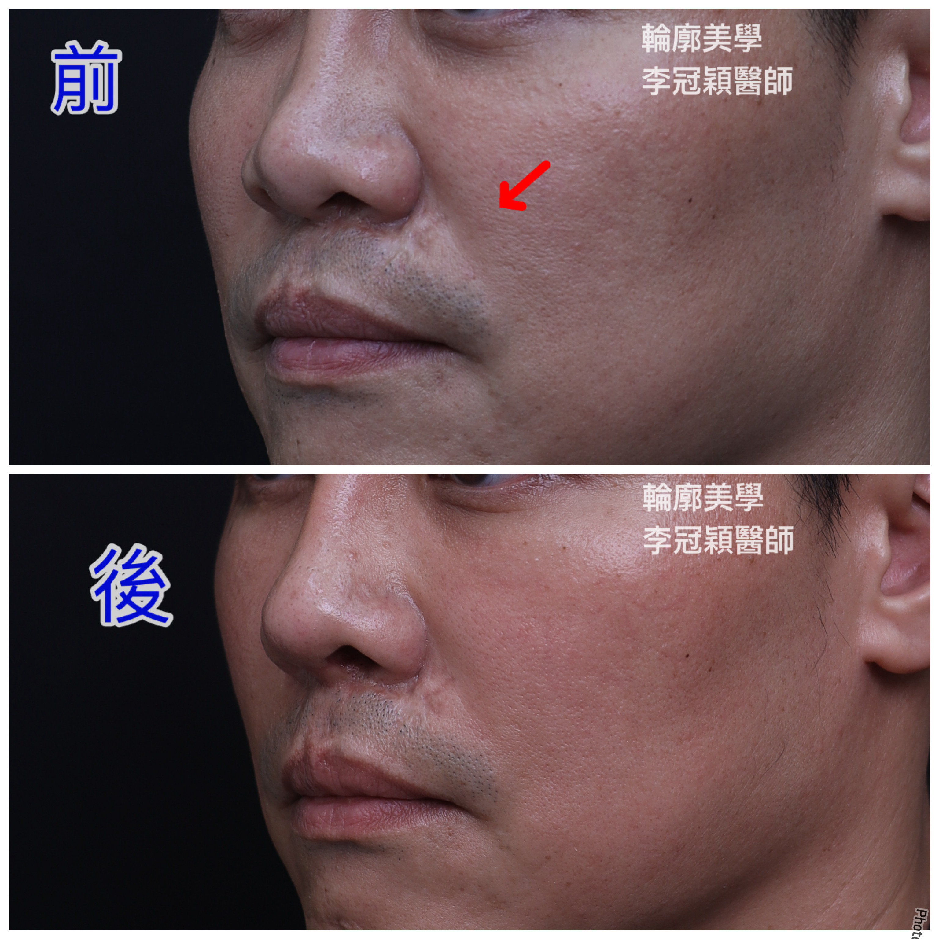 /tmp/phpiQNmpD /tmp/phpiQNmpD