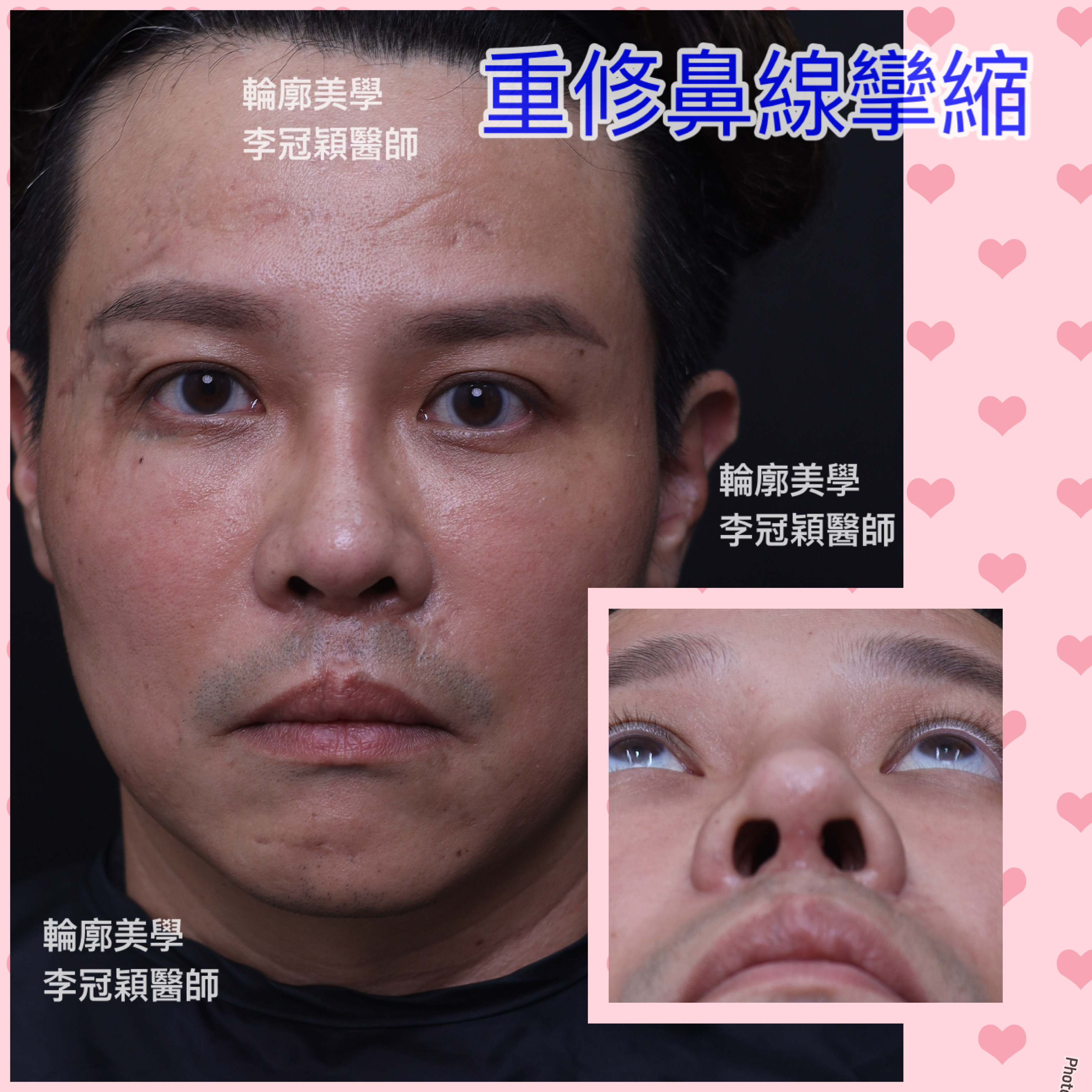 /tmp/phpf8E5qL /tmp/phpf8E5qL