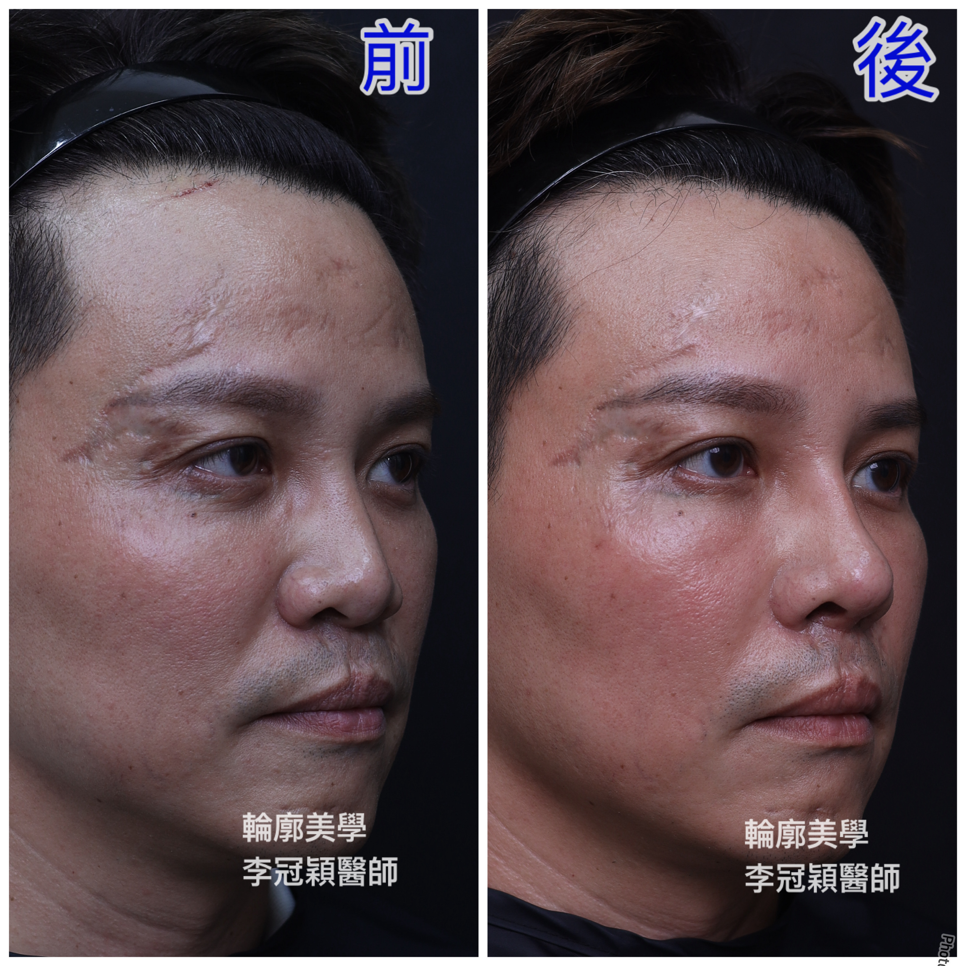 /tmp/phpULugcP /tmp/phpULugcP