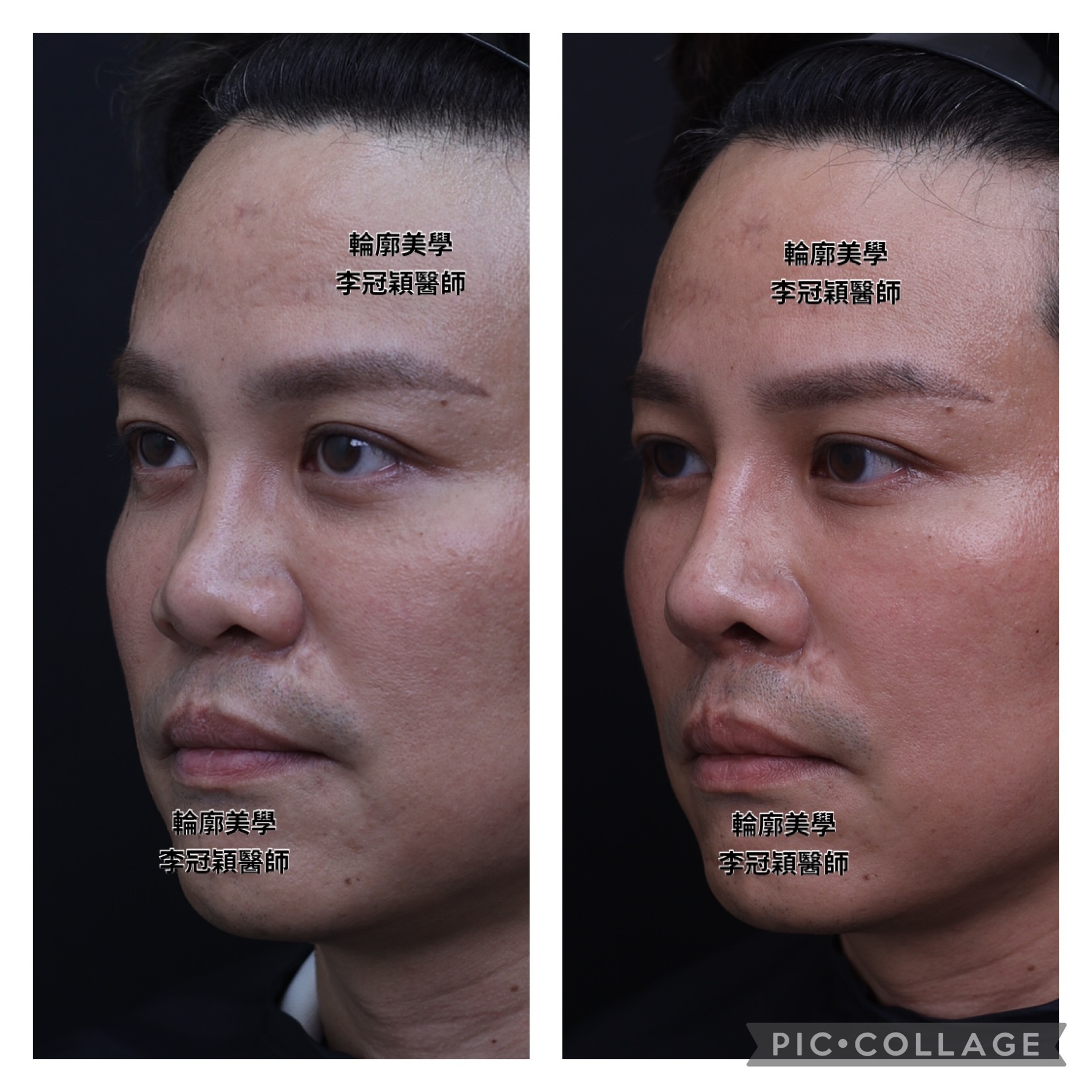 /tmp/phpyU2Zm0 /tmp/phpyU2Zm0